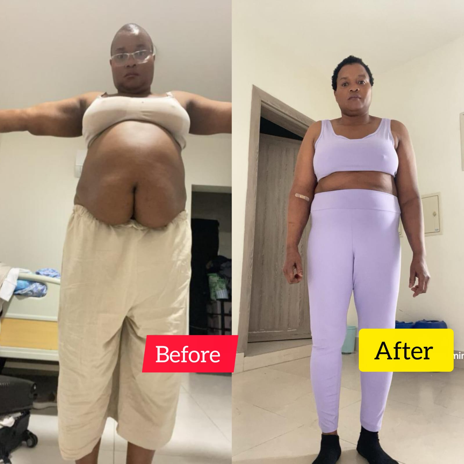 Transformation 2